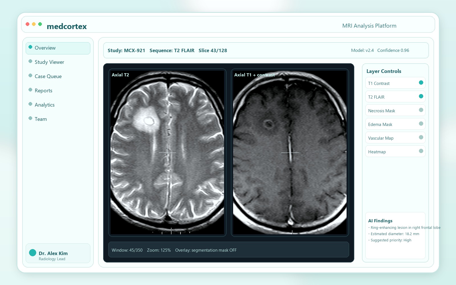 MRI scan viewer with segmentation overlays